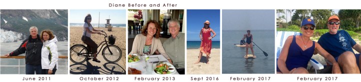 Diane Before and After